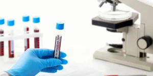 What is Pathology Test? All About Pathology Test you Should Know