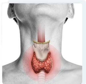 Thyroid treatment
