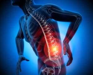 What does an X-ray show for lower back pain?