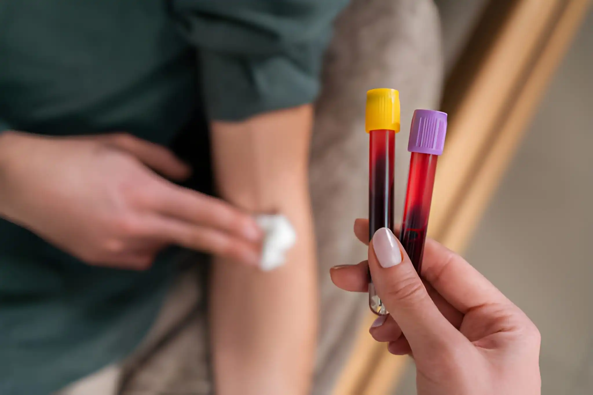 What Is FBC Blood Test in Australia? Explained Simply