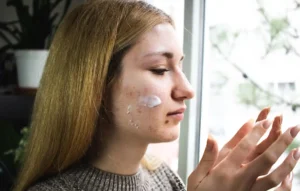 Acne Prescription Online in Australia – What to Expect